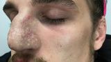 Jonas Dassler zu Beginn seiner täglichen Verwandlung mit angeklebter Nase. Der Übergang von künstlicher Nase und Haut ist nicht zu sehen.