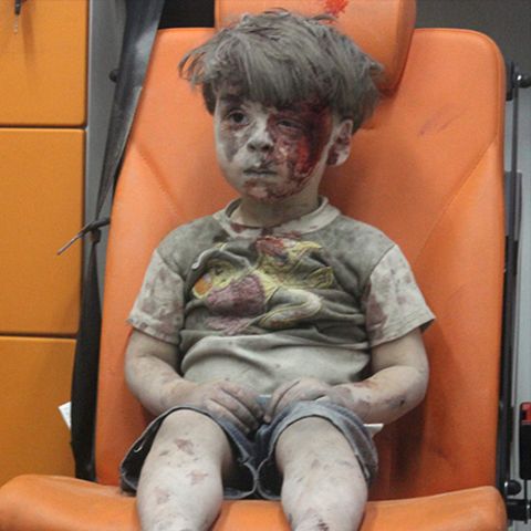 Das Foto von Omran aus dem Jahr 2016 hat sein Leben komplett verändert – aber nicht zum Besseren