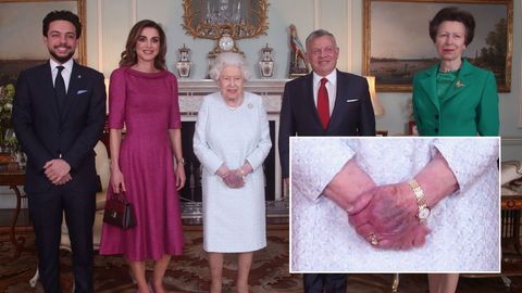 Die linke Hand der britischen Queen ist purpurfarbend angelaufen.