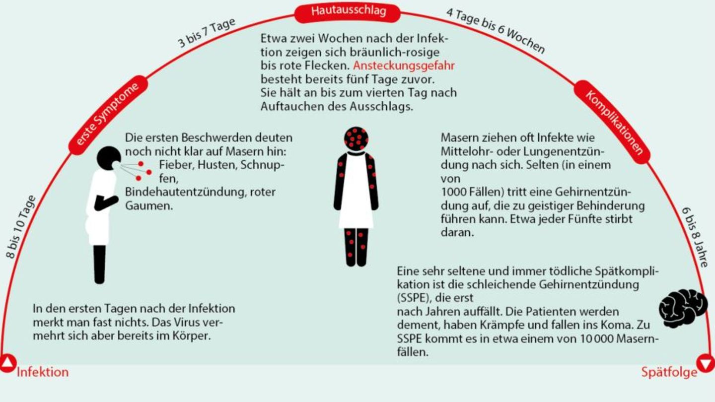 Masern: So verläuft die Krankheit - so funktioniert eine Impfung