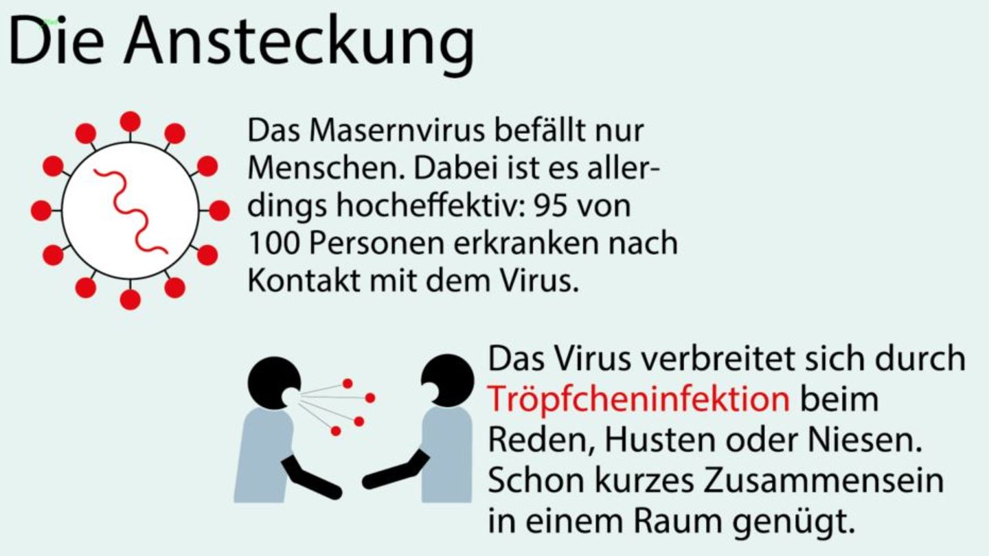 Masern: So verläuft die Krankheit - so funktioniert eine Impfung