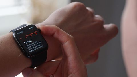 Die neue EKG-Funktion auf der Apple Watch wurde in Deutschland freigeschaltet