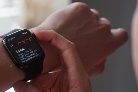 Die neue EKG-Funktion auf der Apple Watch wurde in Deutschland freigeschaltet