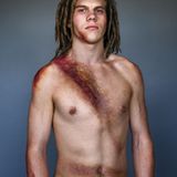 Dion Perry  Überlebte am 23.01.2017.  Dion fuhr bei Regen auf einem schlammigen Feldweg. Der wagen brach aus und drehte sich wie ein Kreisel, bis er in einem Graben landete. Der Wagen war Schrott, doch Dion erlitt nur leichte Verletzungen.