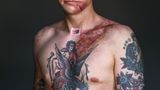 Dan Mason  Überlebte am 02.05.2008.  Dan war gerade 21 geworden. Nach der Spätschicht fuhr er heim, als sein Wagen von einem Betrunkenen gerammt wurde.  Er erlitt mehrere Brüche und Schädelfrakturen.  Ohne Gurt hätte er nicht überlebt.