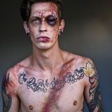 Dylan Chirnside  Überlebte am 15.08.2017  Ein anderes Fahrzeug traf ihn seitlich. Die Folge waren Gehirnverletzungen und Frakturen der Halswirbel.