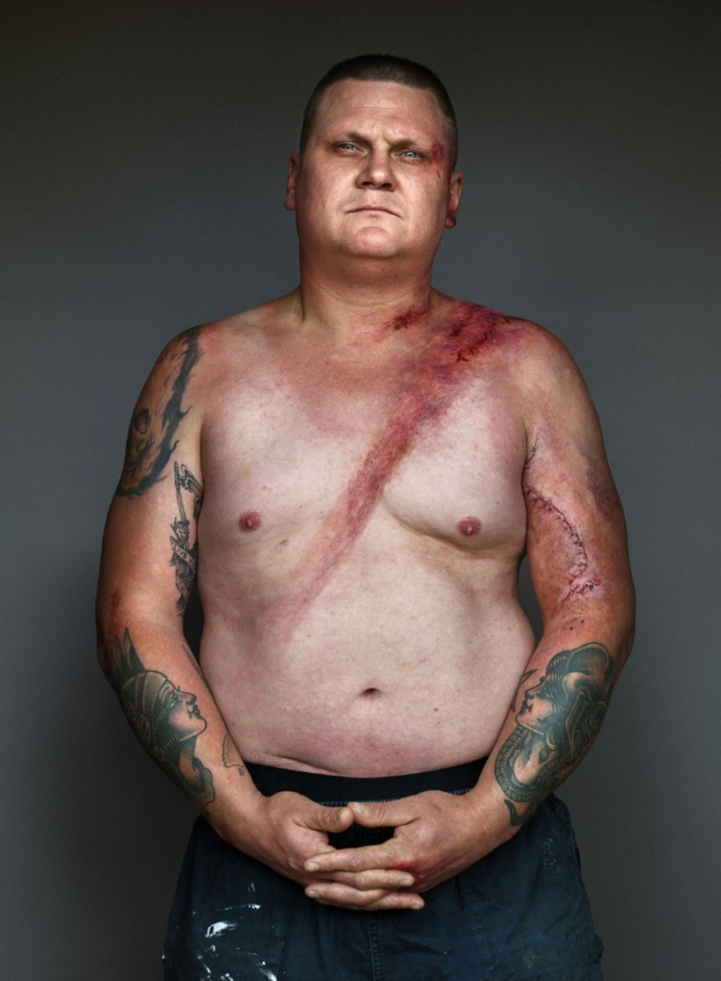 Willy Carberry  Überlebte am 16.03.2014.  Das Auto begann zu schleudern, Willy landete an einem Strommast.