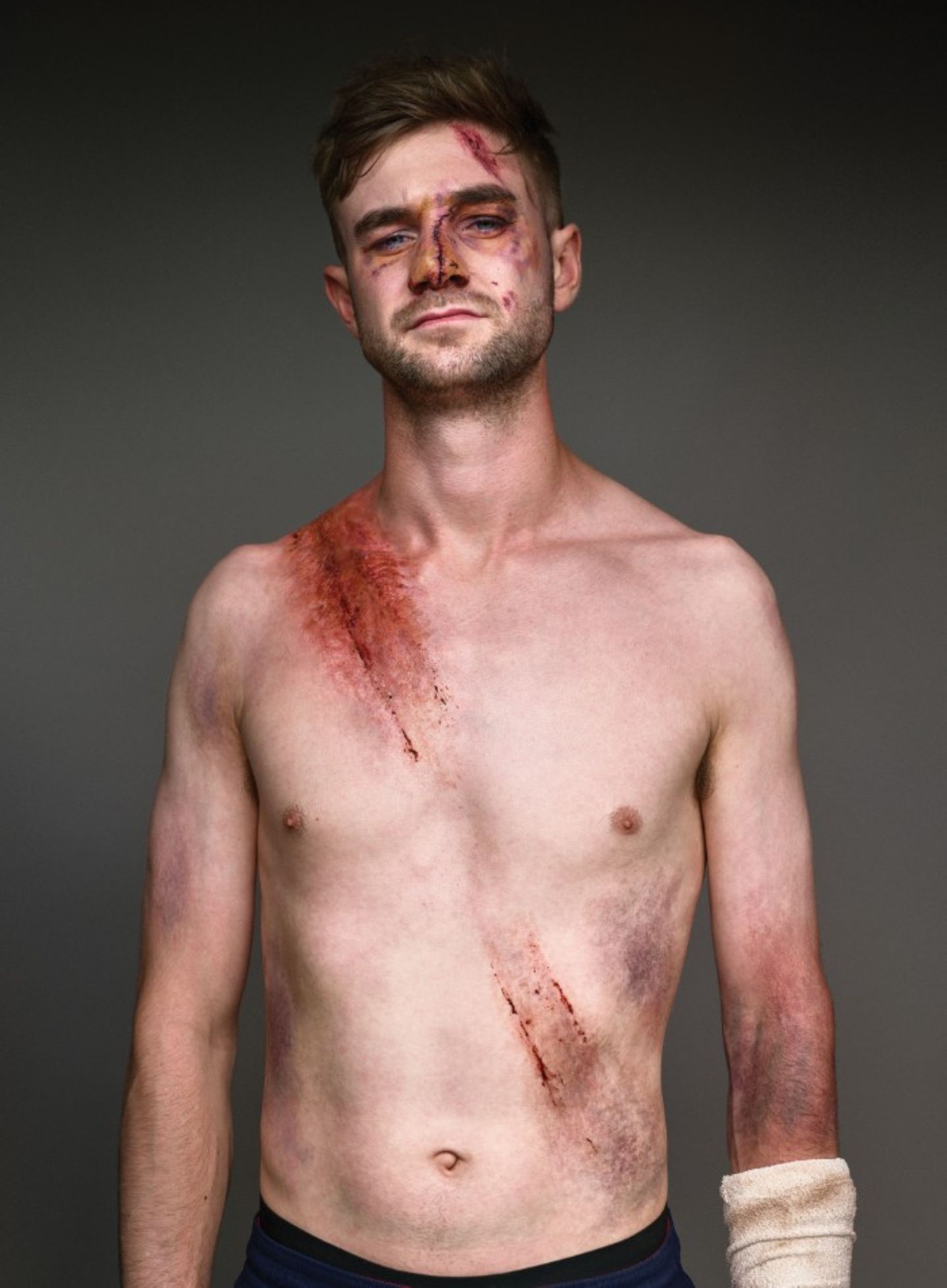 James McDonald  Überlebte am 21.09.2017  Auf seinem gewohnten Weg wurde James von der Sonne geblendet, so landete sein Auto auf der Spur eines LKW mit 18 Rädern. Arm gebrochen und Nase gespalten.
