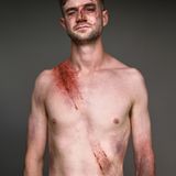 James McDonald  Überlebte am 21.09.2017  Auf seinem gewohnten Weg wurde James von der Sonne geblendet, so landete sein Auto auf der Spur eines LKW mit 18 Rädern. Arm gebrochen und Nase gespalten.