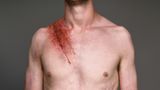 James McDonald  Überlebte am 21.09.2017  Auf seinem gewohnten Weg wurde James von der Sonne geblendet, so landete sein Auto auf der Spur eines LKW mit 18 Rädern. Arm gebrochen und Nase gespalten.