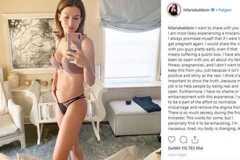 Hilaria Baldwin teilte ihre Sorgen auf Instagram.