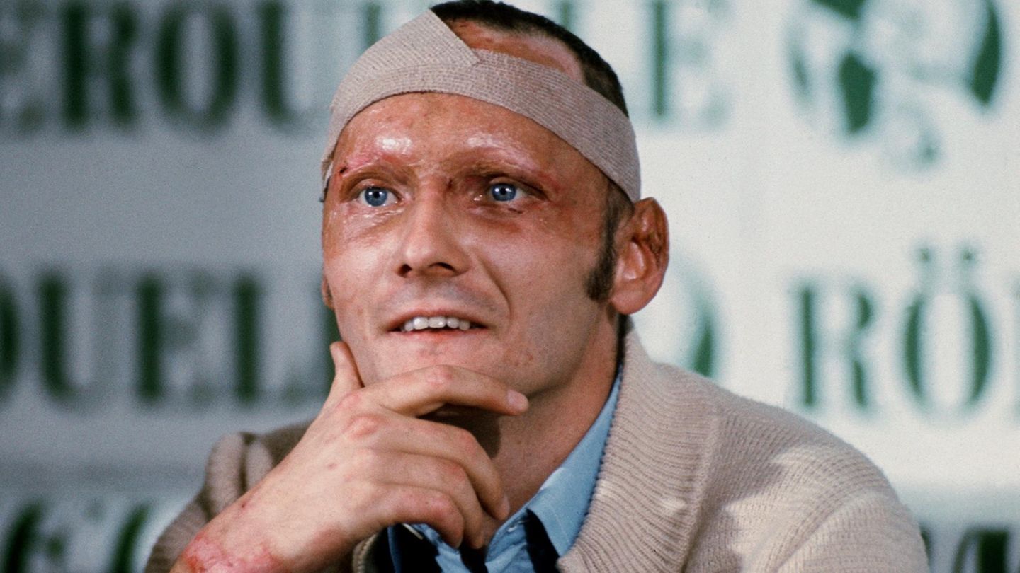 Lauda trägt schwerste Verbrennungen davon. Fünf Wochen später gibt er mit vernarbtem Gesicht, Kopfbandage und Brandwunden eine Pressekonferenz - wenige Tage später steigt wieder ins Auto. Er verpasst nur zwei Rennen.