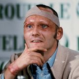 Lauda trägt schwerste Verbrennungen davon. Fünf Wochen später gibt er mit vernarbtem Gesicht, Kopfbandage und Brandwunden eine Pressekonferenz - wenige Tage später steigt wieder ins Auto. Er verpasst nur zwei Rennen.