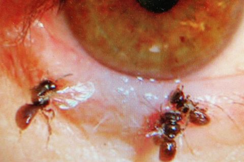 Drei kleine Bienen sitzen am Rand eines aufgezogenen unteren Augenliedes
