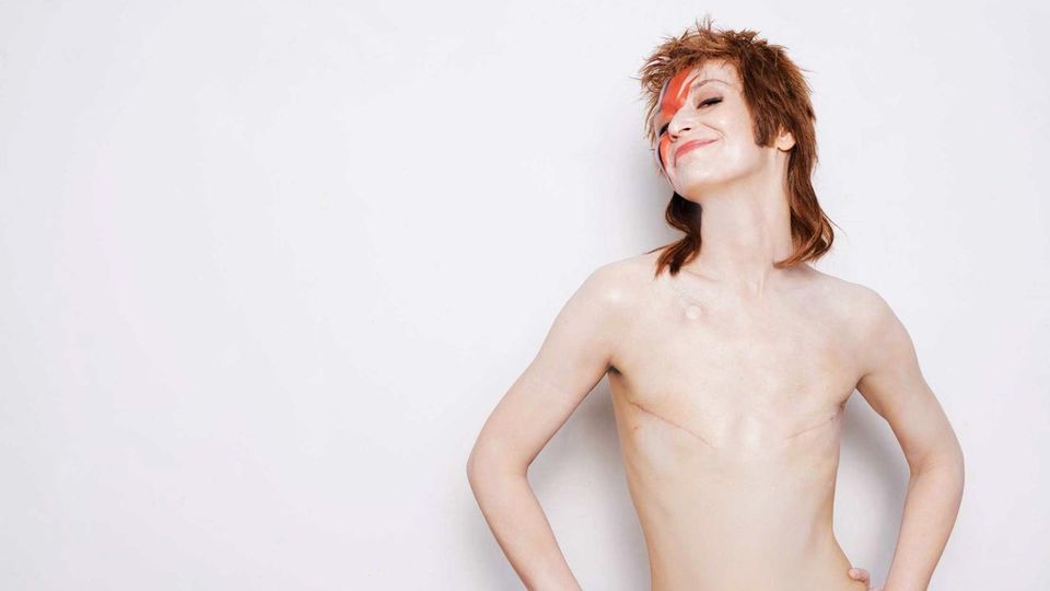 NEON-Reihe "Bin ich schön?": "Frauen kämpfen um ihre Brüste mehr als um ihr Leben" – wenn Krankheiten unser Schönheitsbild verzerren