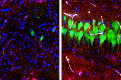 Das Foto zeigt ein nach dem Tod unbehandeltes Schweinegehirn und eines von den Wissenschaftlern bearbeitetes