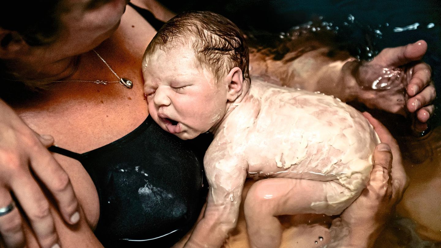 Überzogen mit "Käseschmiere", einer Schutzschicht aus Wasser und Lipiden: Die Tochter Bian der Niederländerin Mariëlle Batelaan kommt im April 2018 zu Hause auf die Welt