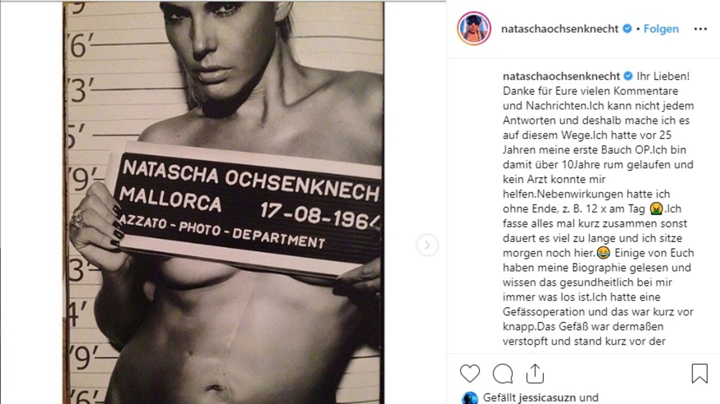 Natascha Ochsenknecht zeigt ihre OP-Narben auf Instagram