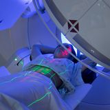 Die Strahlentherapie  Auch die Strahlentherapie folgt meist auf eine Operation mit dem Ziel, mögliche Tumorzellen zu zerstören und einen Rückfall zu verhindern. Bei der herkömmlichen Variante kommt eine energiereiche ionisierende Strahlung zum Einsatz. Sie schädigt das Erbgut der Tumorzellen, sodass sie sich nicht mehr teilen können und absterben. Gesunde Zellen trifft es zwar auch, allerdings können sich diese oft besser erholen. Zudem hat sich die Technik enorm verbessert, Tumoren können heute gezielter bestrahlt werden als noch vor Jahrzehnten, was auch die Nebenwirkungen verringert. Wie stark diese ausfallen, hängt aber von der Strahlendosis ab. Möglich sind Müdigkeit, Appetitlosigkeit, Übelkeit, Erbrechen, Durchfall, Kopfschmerzen, Haut- und Schleimhautreizungen sowie Entzündungen. Eine spezielle Form der Strahlentherapie ist die Brachytherapie, eine Strahlentherapie von innen. Hierbei führt der Arzt kleine radioaktive Partikel in den Tumor oder in seine Nähe ein.