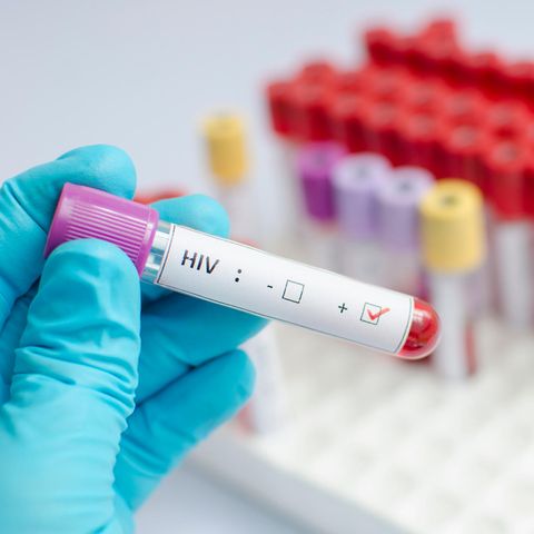 Aids-Medikament stoppt HIV-Übertragung beim Sex
