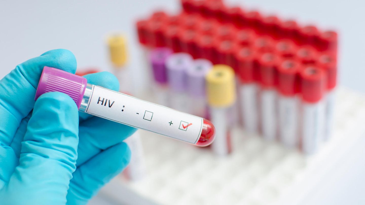 Aids-Medikament stoppt HIV-Übertragung beim Sex