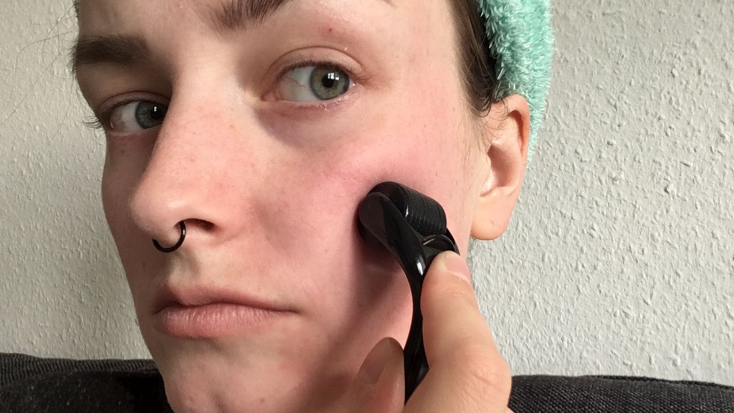 Microneedling Ich Habe Einen Dermaroller Zu Hause Getestet Stern De