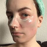 Microneedling für zu Hause: Hilft der Dermaroller gegen Pickelmale?