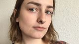 Microneedling für zu Hause: Hilft der Dermaroller gegen Pickelmale?