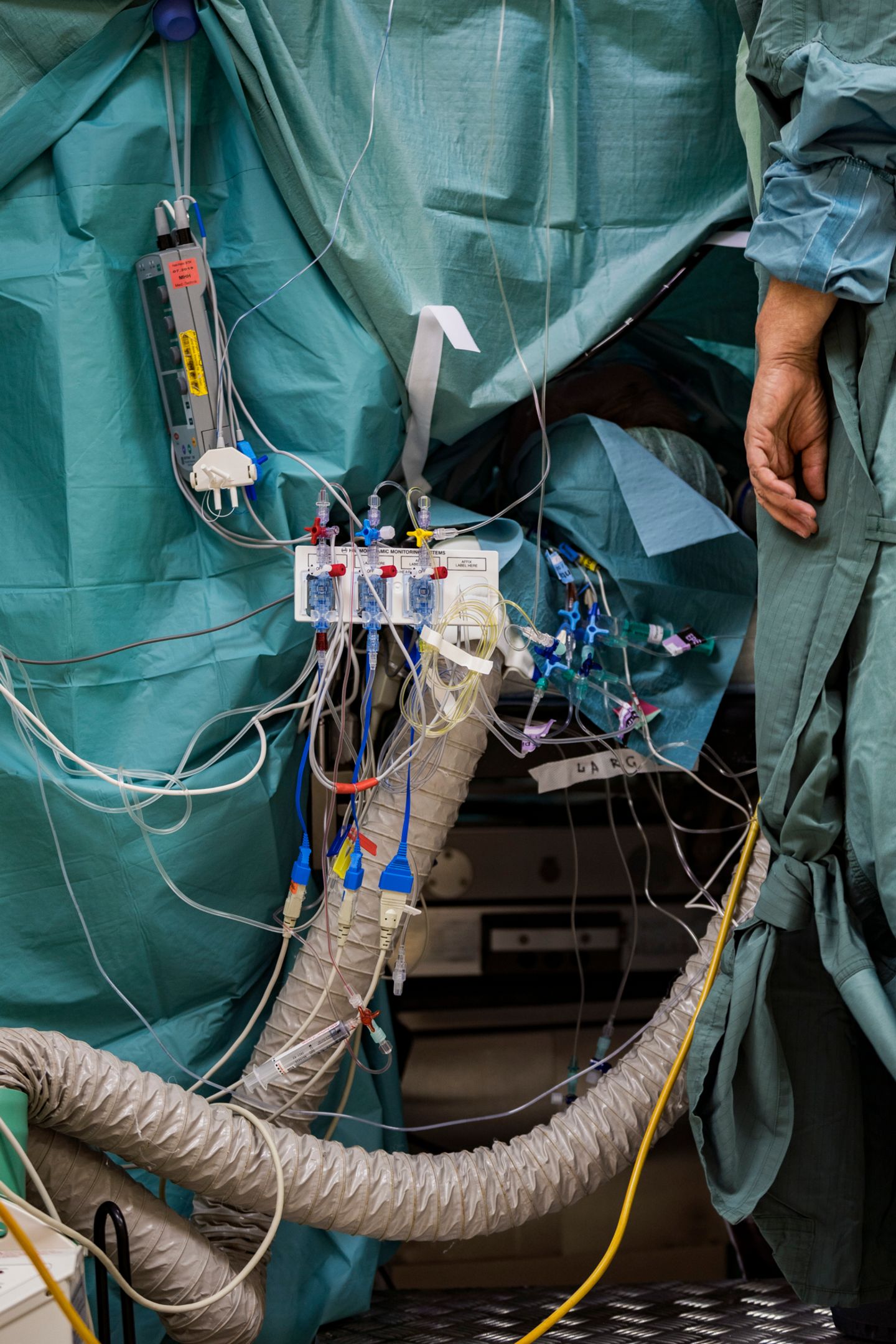 Organspende