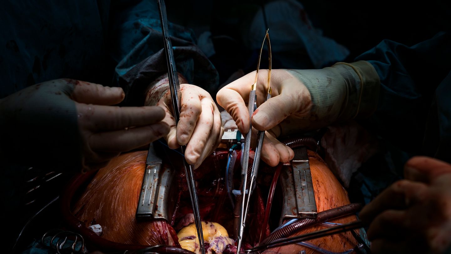 Organspende