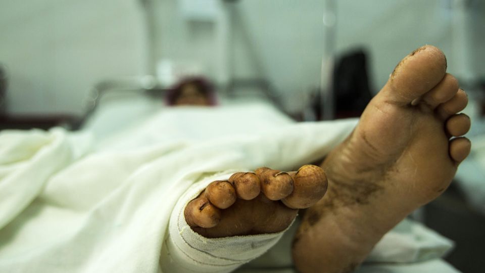 Notfallarzt Afghanistan Patient Notfallarzt Afghanistan Patient