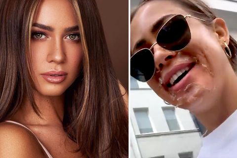 Ex-Bachelorette Jessica Paszka hat sich einem chemischen Peeling unterzogen, das zu Hautrötungen führt.