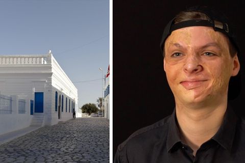 Attentat auf Djerba: Adrian Esper überlebt mit schweren Verbrennungen