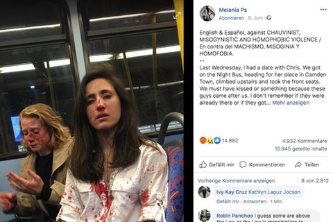 Melania trägt eine weiße Bluse, die voller Blut ist. Dahinter sitzt die blonde Chris mit blutverschmiertem Gesicht