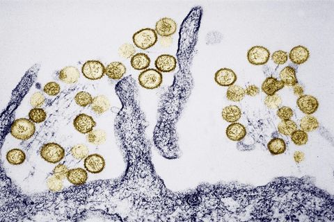 Das Hantavirus breitet sich wieder verstärkt in Deutschland aus