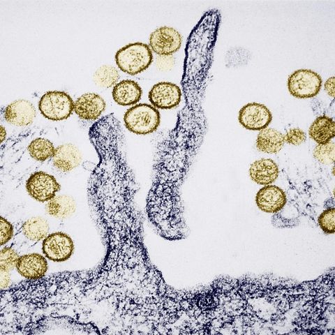 Das Hantavirus breitet sich wieder verstärkt in Deutschland aus