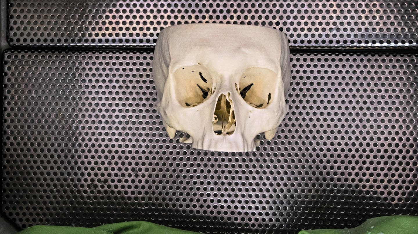 Mailand, Italien: Im Druckverfahren erstellte Implantate wie diese in Mailand vom Technologie-Unternehmen Skorpion Engineering erstellte Rekonstruktion eines Schädelknochens sollen einmal routinemäßig in der Orthopädie zum Einsatz kommen
