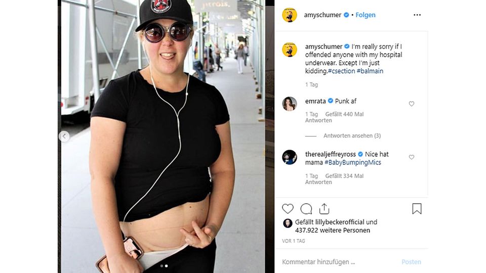 Amy Schumer zeigt auf dem Foto ihre Kaiserschnittnarbe