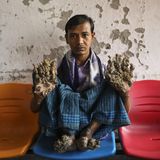 "Baummann" in Bangladesch