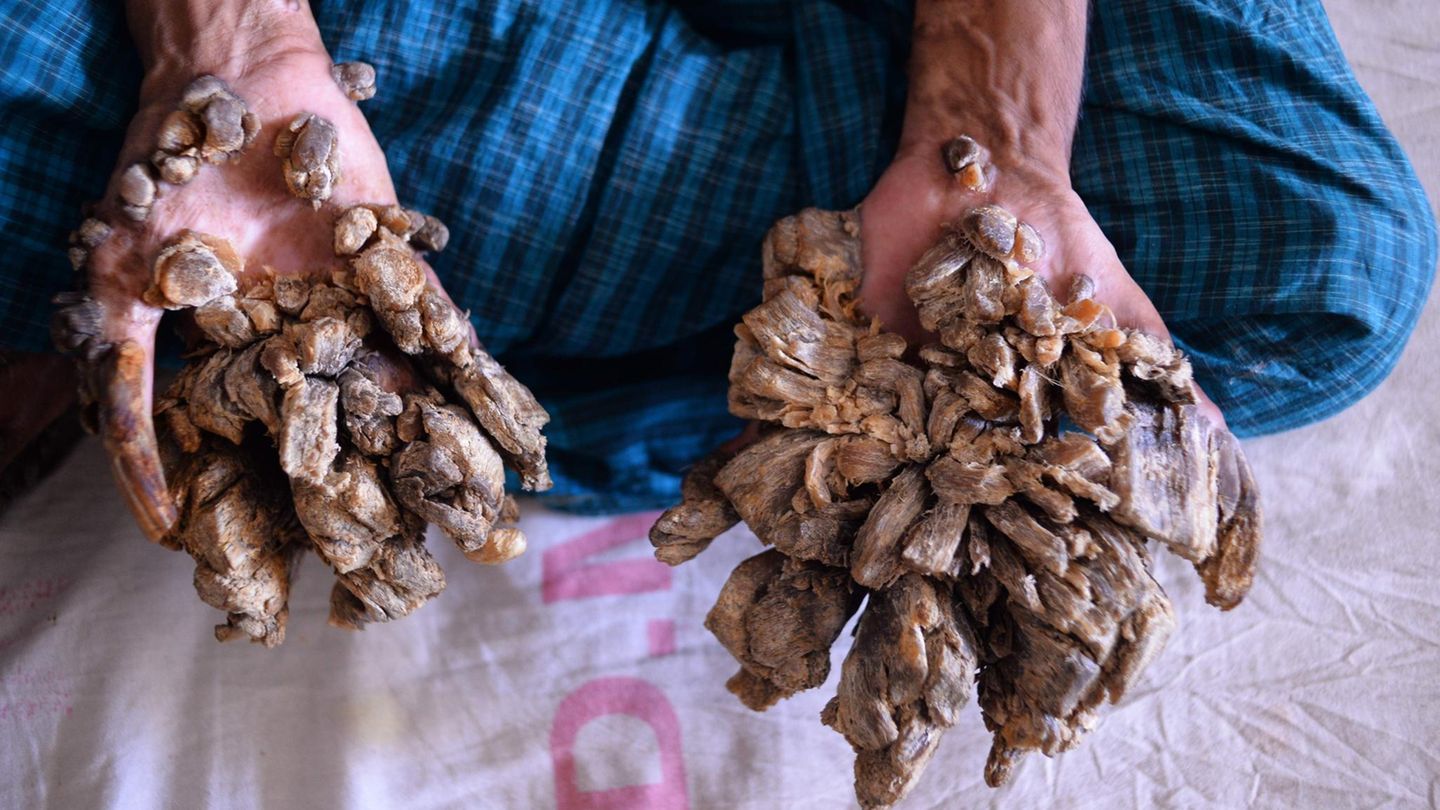 "Baummann" in Bangladesch