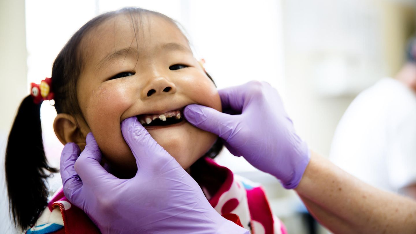 Zucker in der Mongolei: Diese Fünfjährige hat schwere Karies