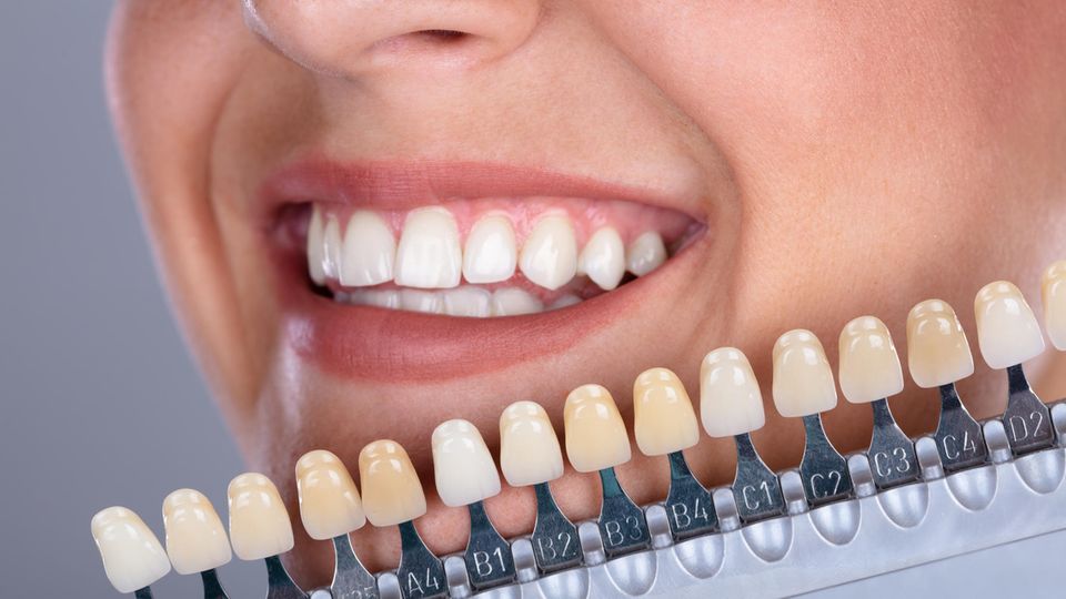 Ein professionelles Bleaching der Zähne ist nur beim Zahnarzt möglich