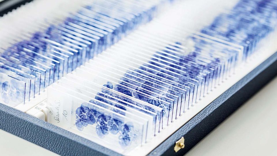 Ein Hirnforscher entdeckt den Wert des Vergessens Präparate von Taubengehirnen