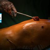 OP-Vorbereitungen an einem Oberkörper.