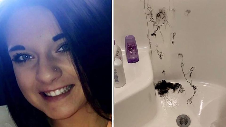 Die lächelnde Ashley Rose als sie noch ihre Haare hatte neben einem Foto der ausgefallenen Haare im Bad