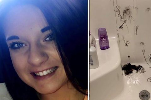 Die lächelnde Ashley Rose als sie noch ihre Haare hatte neben einem Foto der ausgefallenen Haare im Bad