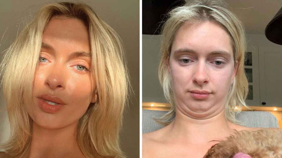Influencerin zeigt den Unterschied zwischen Schönheit und Realität