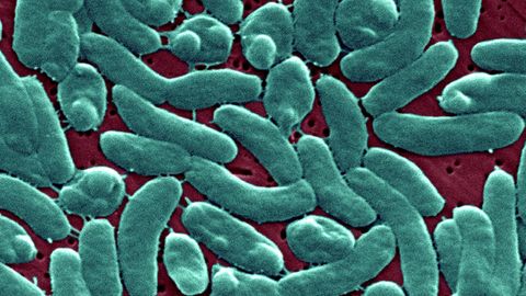 Frau stirbt durch Vibrionen aus Ostsee: Bakterien der Gattung Vibrio vulnificus
