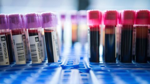 Bluttest: Röhrchen mit Blutproben stehen während einer Blutspende in Behältern