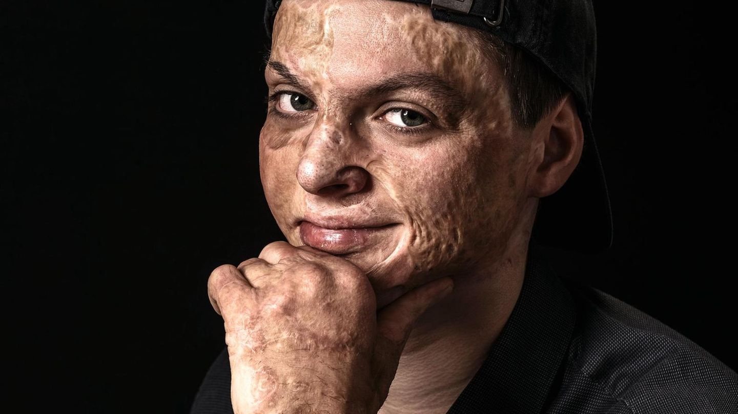 Adrian Esper (20)